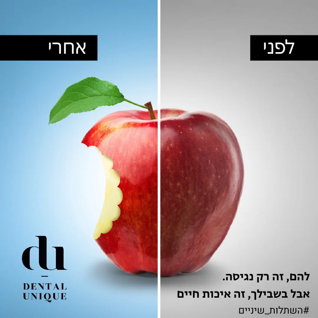 לאחרים זה רק נגיסה. בשבילך, זה איכות חיים
